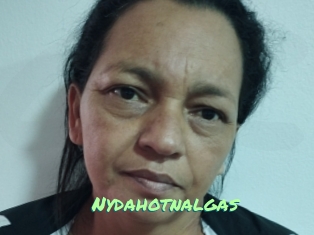 Nydahotnalgas
