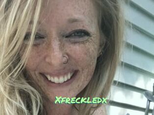 Xfreckledx